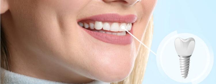 خدمات Tooth Guard للأسنان